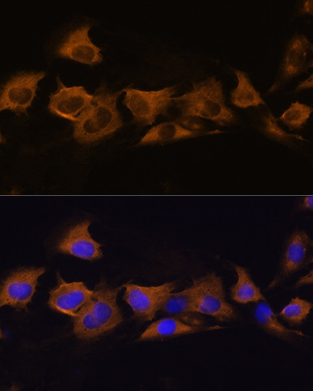 ATP1B2 Antibody in Immunocytochemistry (ICC/IF)