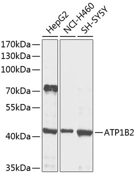 ATP1B2 Antibody in Western Blot (WB)