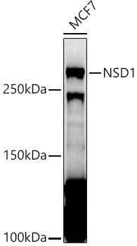 NSD1 Antibody in Western Blot (WB)