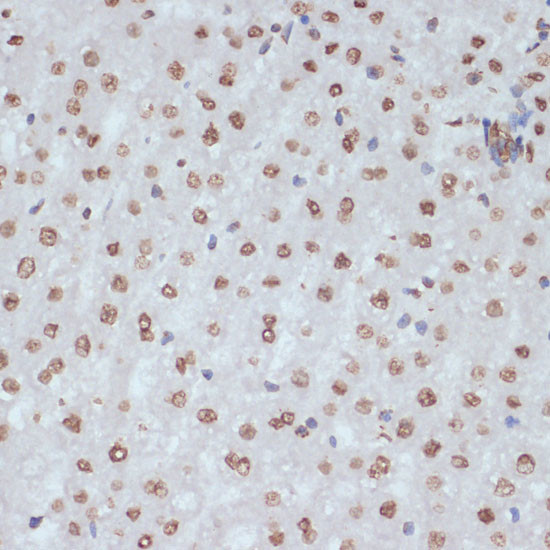 Phospho-CDK1 (Tyr15) Antibody in Immunohistochemistry (Paraffin) (IHC (P))