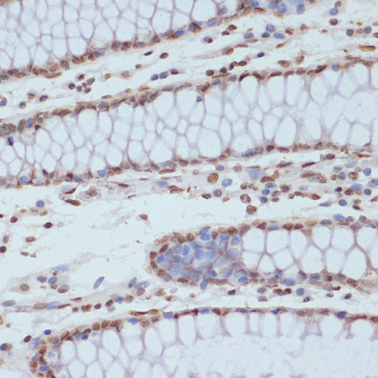 Phospho-CDK1 (Tyr15) Antibody in Immunohistochemistry (Paraffin) (IHC (P))