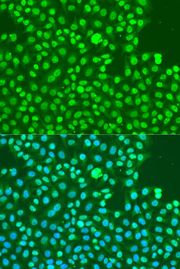 Phospho-DNA-PK (Ser2056) Antibody in Immunocytochemistry (ICC/IF)