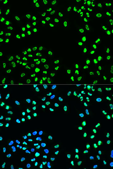 Phospho-ATR (Ser428) Antibody in Immunocytochemistry (ICC/IF)