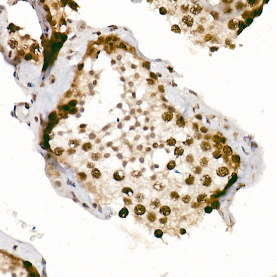 Phospho-ATR (Ser428) Antibody in Immunohistochemistry (Paraffin) (IHC (P))