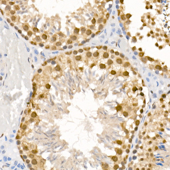 Phospho-ATR (Ser428) Antibody in Immunohistochemistry (Paraffin) (IHC (P))