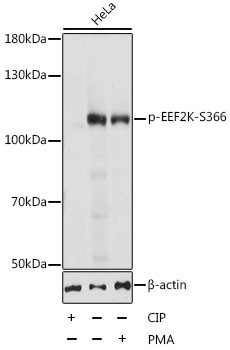 Phospho-EEF2K (Ser366) Antibody in Western Blot (WB)