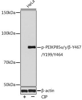 Phospho-PI3K p85/p55 (Tyr467, Tyr199, Tyr464) Antibody in Western Blot (WB)