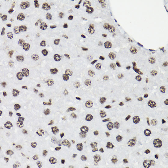 Phospho-STAT5A/B (Tyr694) Antibody in Immunohistochemistry (Paraffin) (IHC (P))