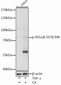 Phospho-IKK alpha/beta (Ser176, Ser180) Antibody in Western Blot (WB)