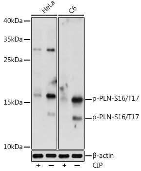 Phospho-Phospholamban (Ser16, Thr17) Antibody in Western Blot (WB)