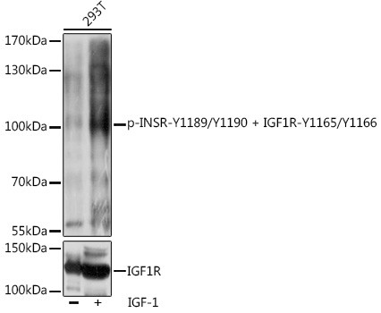 Phospho-IR/IGF1R (Tyr1165, Tyr1166, Tyr1189, Tyr1190) Antibody in Western Blot (WB)