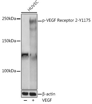 Phospho-VEGF Receptor 2 (Tyr1175) Antibody in Western Blot (WB)