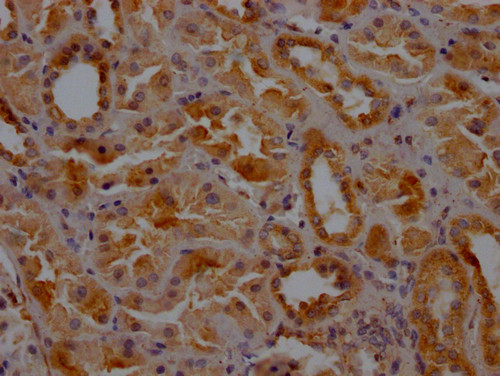 Clathrin Heavy Chain Antibody in Immunohistochemistry (Paraffin) (IHC (P))