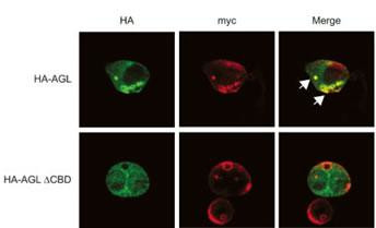 AGL Antibody in Immunocytochemistry (ICC/IF)