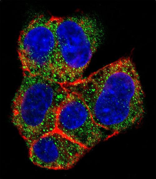 AGL Antibody in Immunocytochemistry (ICC/IF)