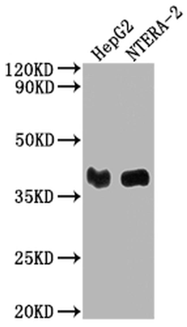 LCMT1 Antibody in Western Blot (WB)