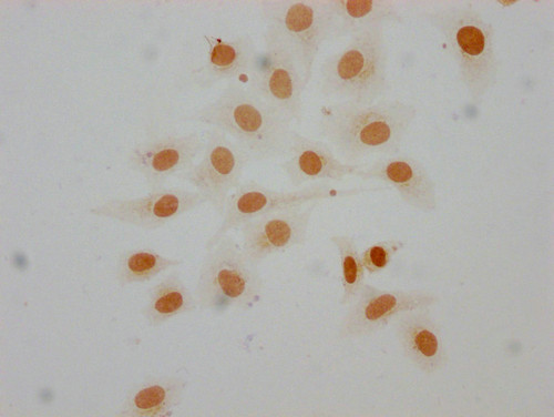 Mono-Methyl-Histone H1.3 (Lys16) Antibody in Immunocytochemistry (ICC/IF)