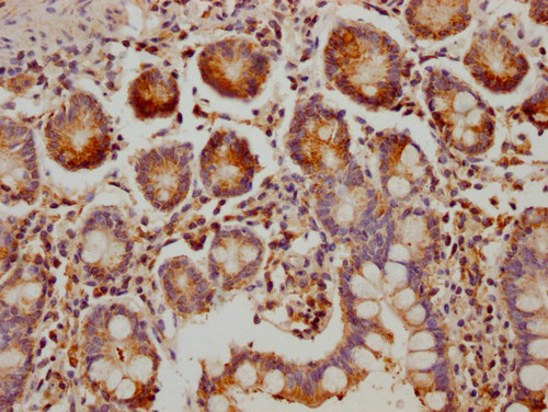 MUC5B Antibody in Immunohistochemistry (Paraffin) (IHC (P))