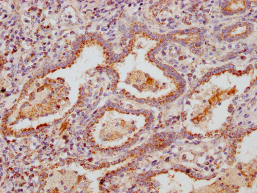 MUC5B Antibody in Immunohistochemistry (Paraffin) (IHC (P))