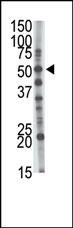 GCNT1 Antibody in Western Blot (WB)