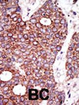 GCNT1 Antibody in Immunohistochemistry (Paraffin) (IHC (P))