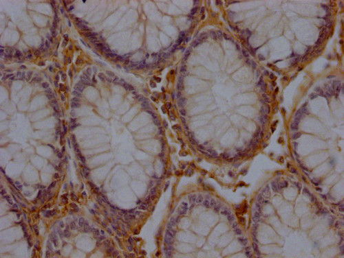 RHBDF2 Antibody in Immunohistochemistry (Paraffin) (IHC (P))