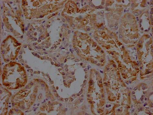 RHBDF2 Antibody in Immunohistochemistry (Paraffin) (IHC (P))