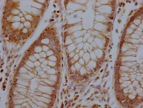 RHBDF2 Antibody in Immunohistochemistry (Paraffin) (IHC (P))