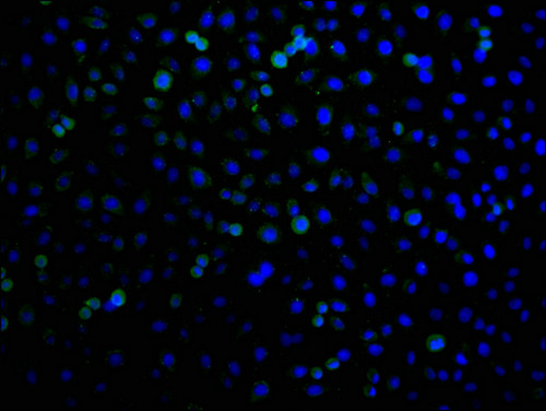 RHBDF2 Antibody in Immunocytochemistry (ICC/IF)