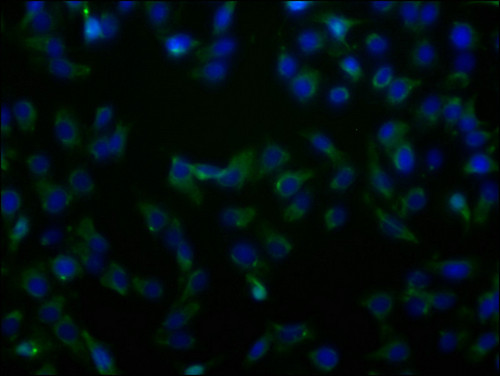 SLC23A2 Antibody in Immunocytochemistry (ICC/IF)