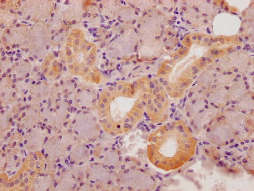 STATH Antibody in Immunohistochemistry (Paraffin) (IHC (P))