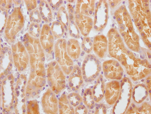 STATH Antibody in Immunohistochemistry (Paraffin) (IHC (P))