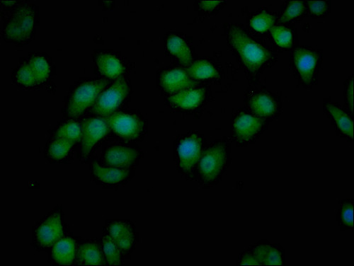 VDAC3 Antibody in Immunocytochemistry (ICC/IF)