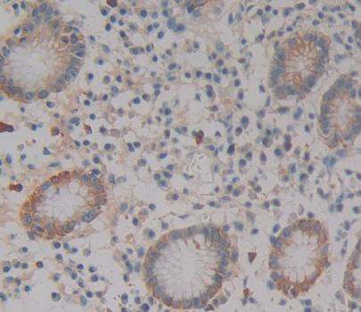 GYPE Antibody in Immunohistochemistry (Paraffin) (IHC (P))