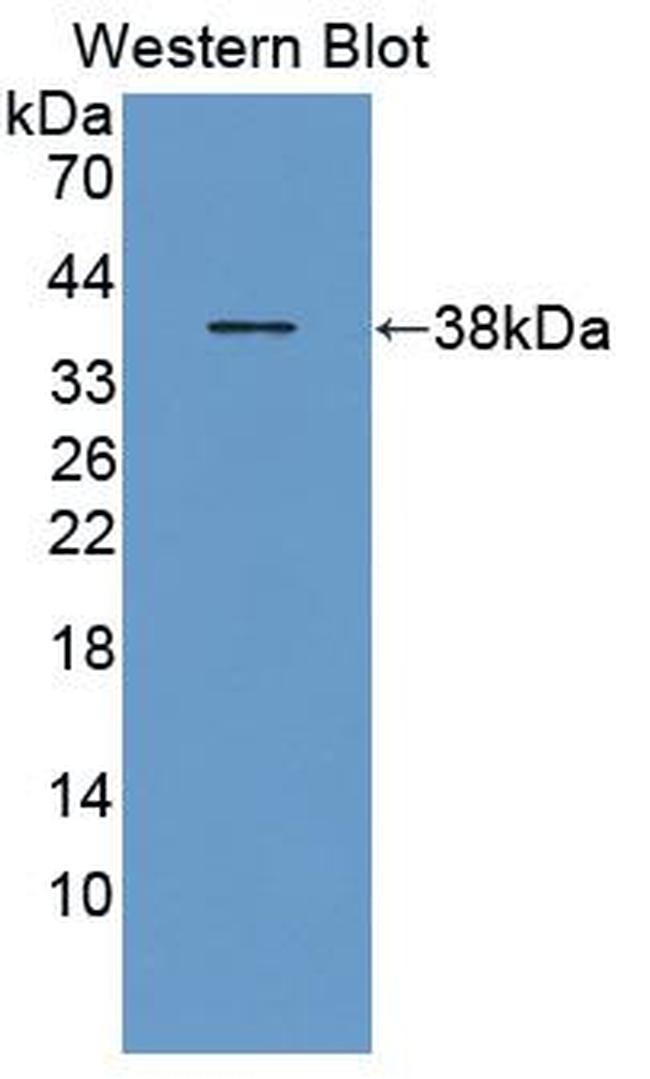 GYPE Antibody in Western Blot (WB)