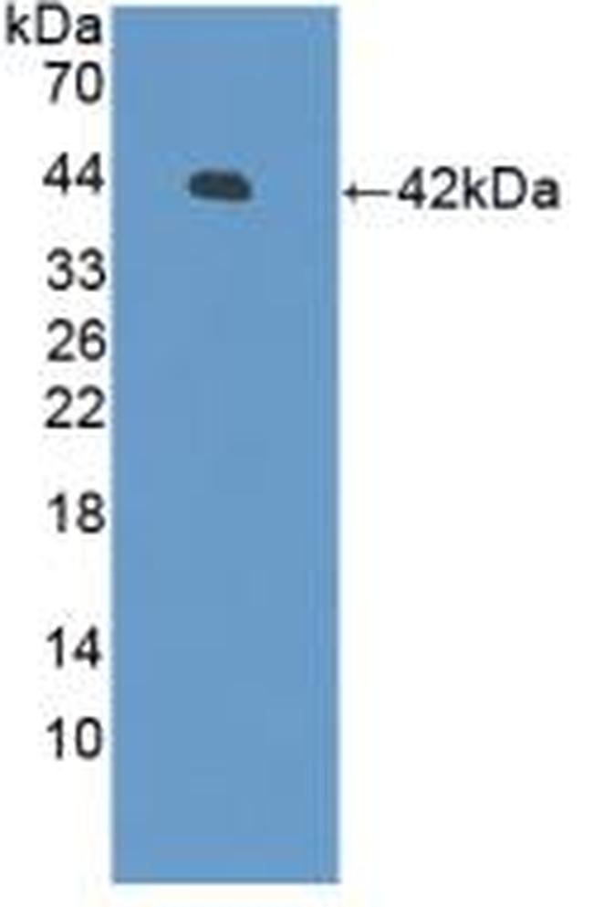 beta-Defensin 126 Antibody in Western Blot (WB)