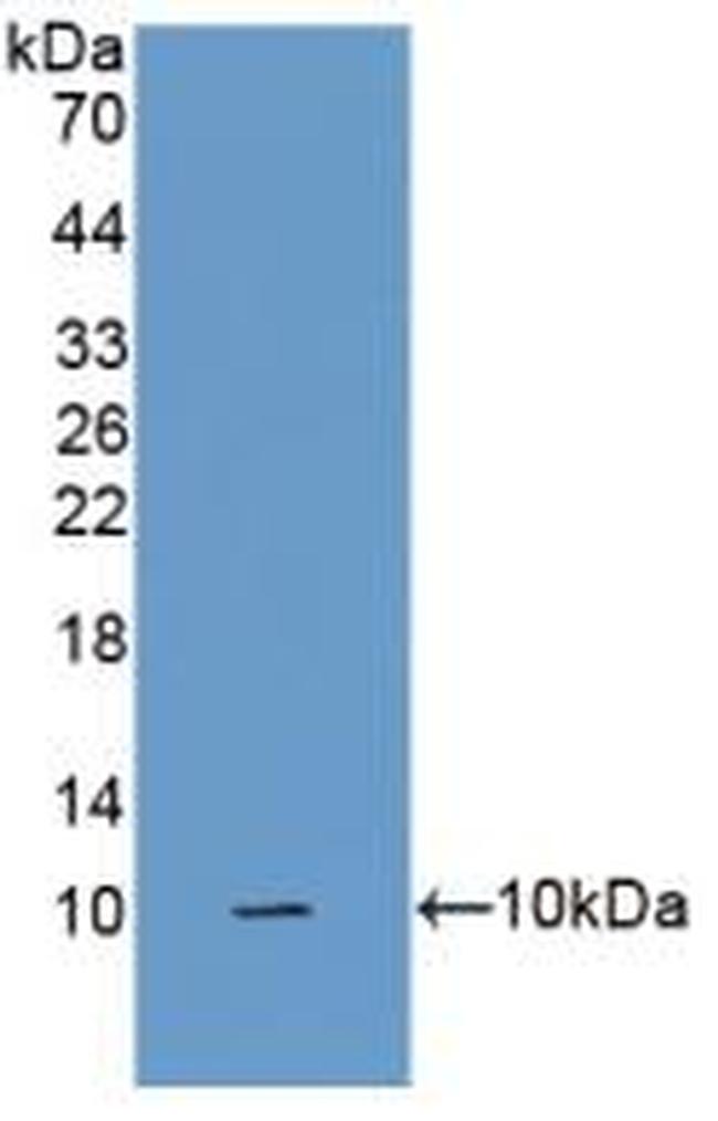 SFTA2 Antibody in Western Blot (WB)