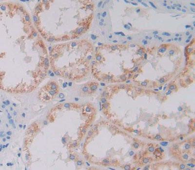 XYLT2 Antibody in Immunohistochemistry (Paraffin) (IHC (P))