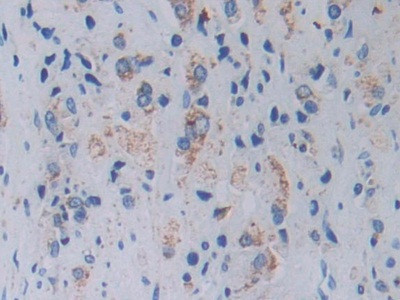 TOP3A Antibody in Immunohistochemistry (Paraffin) (IHC (P))