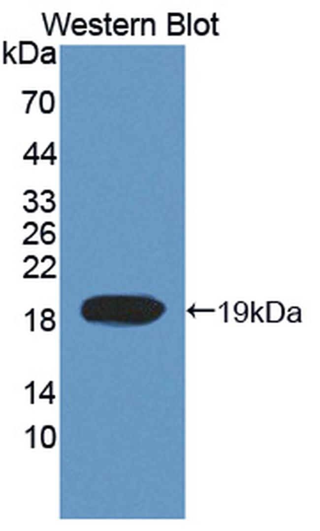 TOP3A Antibody in Western Blot (WB)