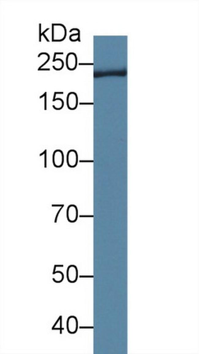 TCHH Antibody in Western Blot (WB)