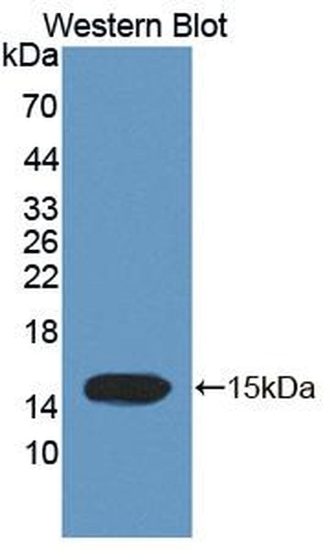 TCHH Antibody in Western Blot (WB)