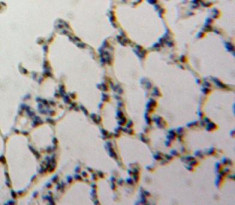 TBX4 Antibody in Immunohistochemistry (Paraffin) (IHC (P))