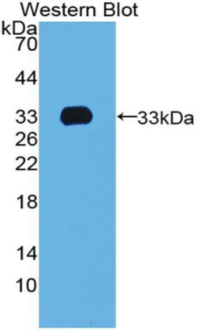 TBX4 Antibody in Western Blot (WB)