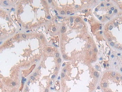 SRY Antibody in Immunohistochemistry (Paraffin) (IHC (P))