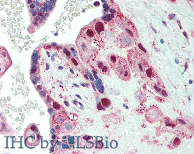 Spectrin beta-4 Antibody in Immunohistochemistry (Paraffin) (IHC (P))