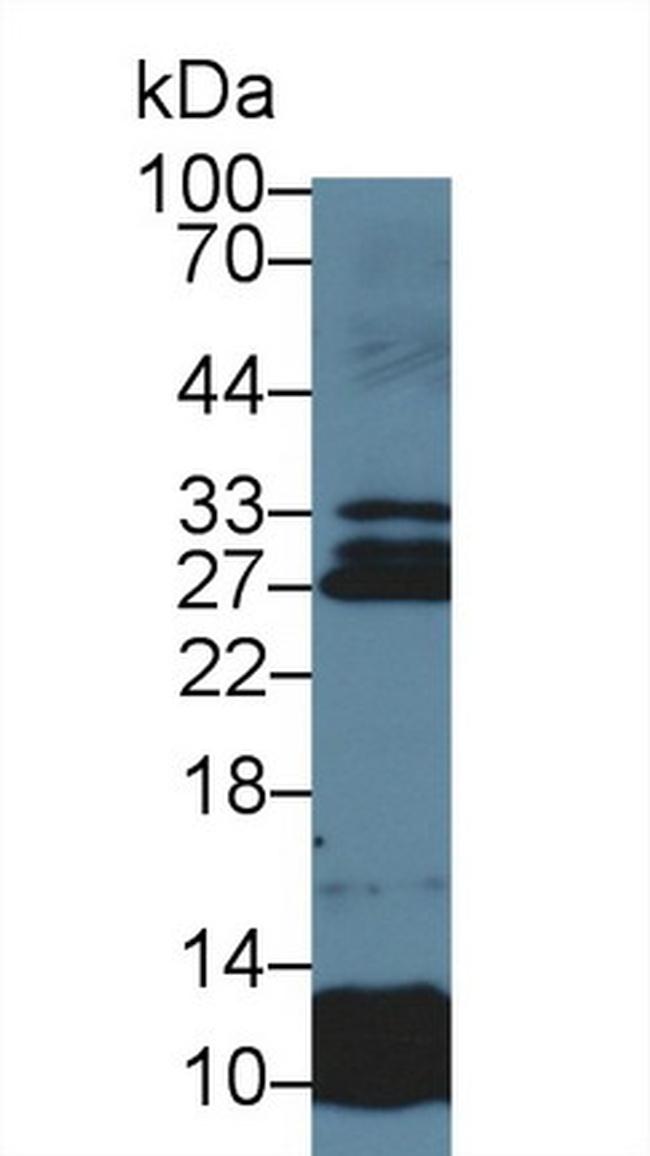 Sostdc1 Antibody in Western Blot (WB)