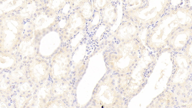 SGPL1 Antibody in Immunohistochemistry (Paraffin) (IHC (P))