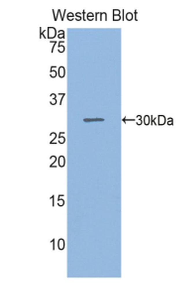 SGPL1 Antibody in Western Blot (WB)