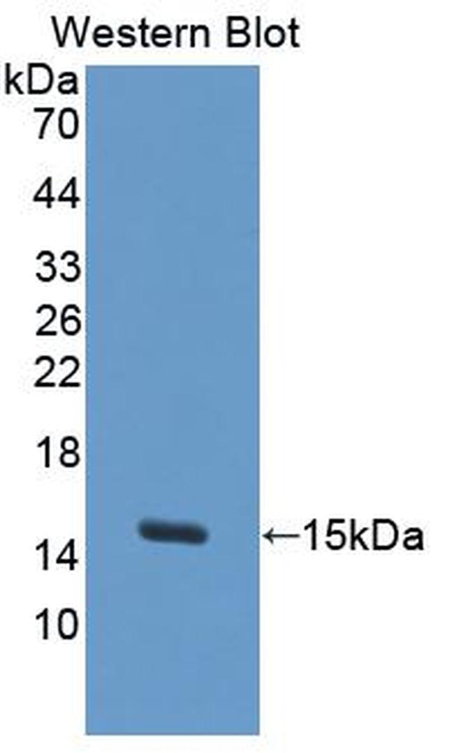 S100A7A Antibody in Western Blot (WB)